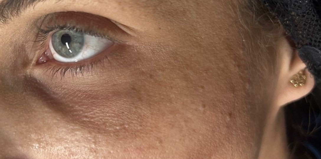 שקעי-עיניים